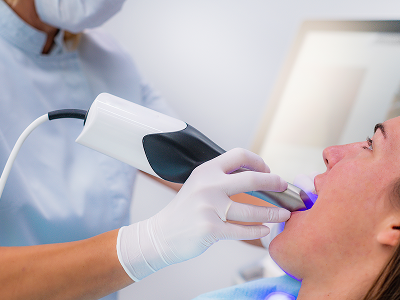 Dental Fillings