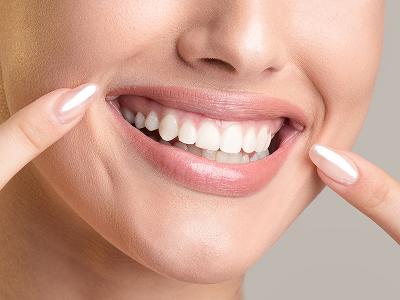 Dental Crowns