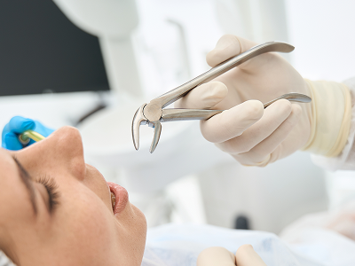Tooth Extractions